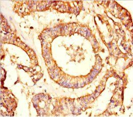 NRBP2 Antibody