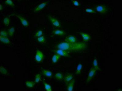 NRDC antibody