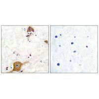 NRG1 Antibody