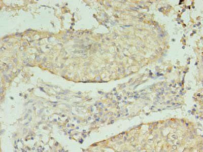 NRG2 Antibody
