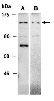 NRIP1 antibody