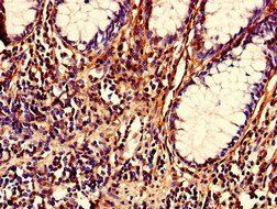 NRIP2 Antibody
