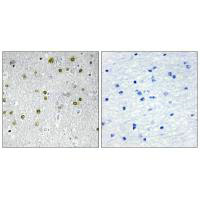 NRIP2 Antibody