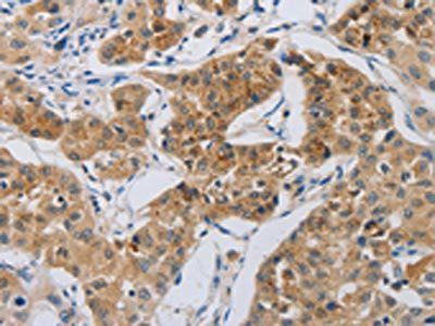 NRP1 Antibody