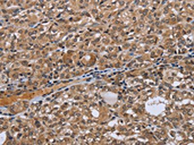 NRP2 antibody