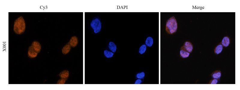 NRSF/REST antibody