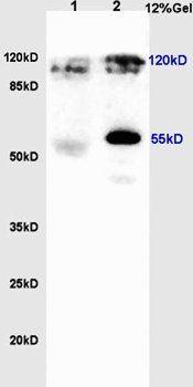 NRSF/REST antibody