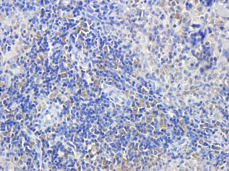 NRSF, REST Protein antibody