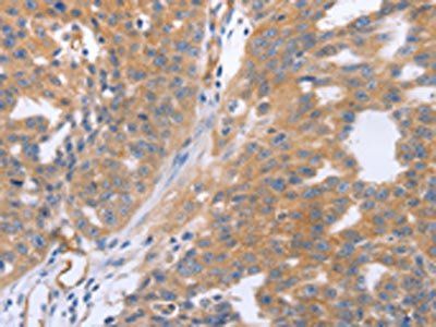 NRTN Antibody