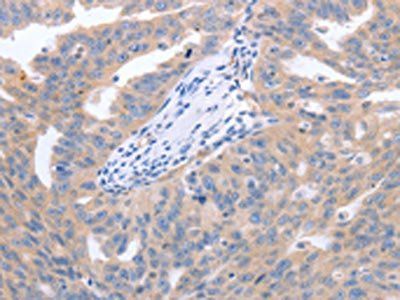 NRTN Antibody