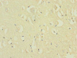 NRXN1 Antibody