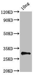 NS antibody