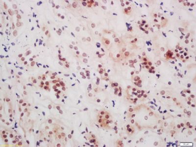 NS5ATP9 Rabbit Polyclonal Antibody