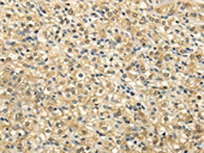 NSD1 Antibody