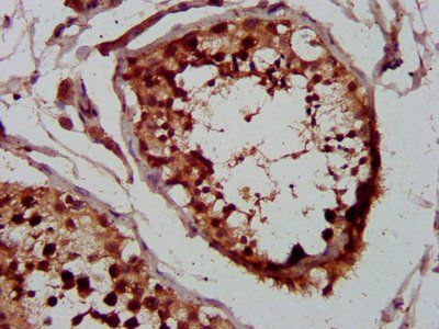 NSD2 Antibody