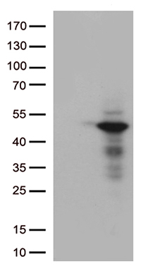 NSD3 (WHSC1L1) antibody