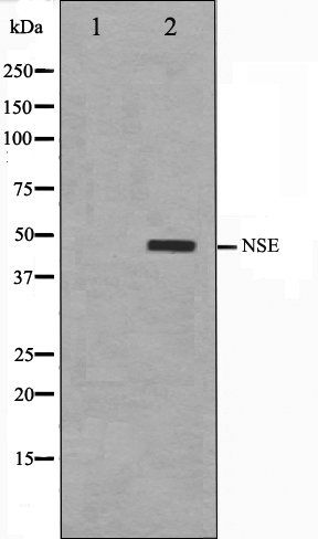 NSE antibody