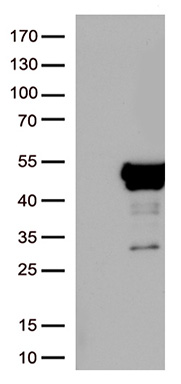 NSE (ENO2) antibody