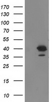 NSE2 (NSMCE2) antibody