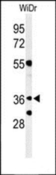 NSE4A antibody