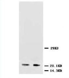 Anti-NSE/ENO2 Antibody