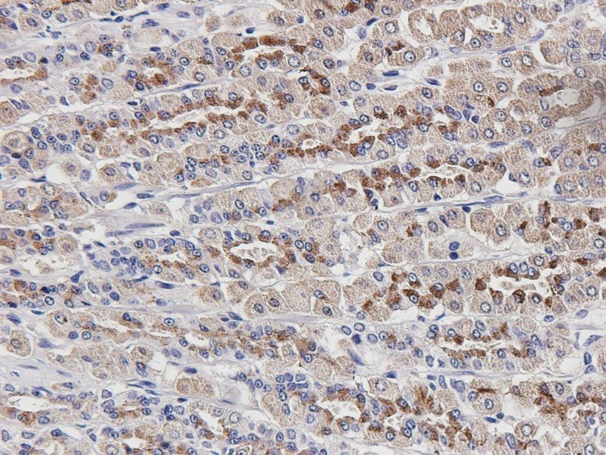 NSF Rabbit Polyclonal Antibody