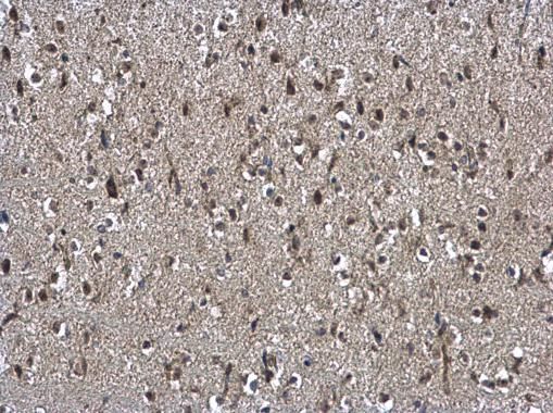 NSFL1C antibody [N1C2]