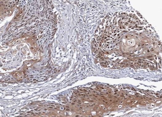 NSFL1C Rabbit Polyclonal Antibody