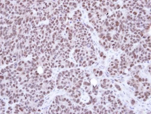 NSMCE1 antibody