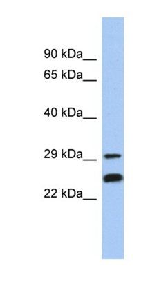 NSMCE2 antibody