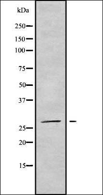 NSMCE2 antibody