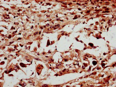 NSMCE2 Antibody