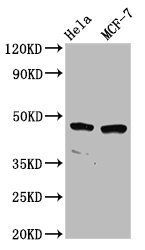 NSUN5 Antibody