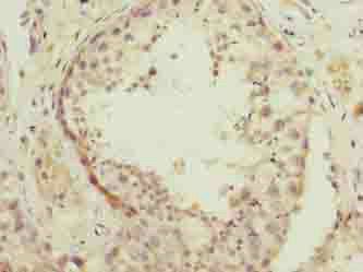 NSUN7 Antibody