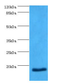 NT-proBNP antibody