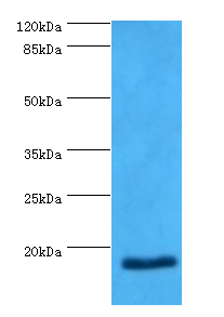 NPPB Antibody