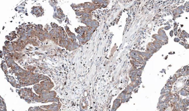 NT5C2 antibody [N2C1], Internal