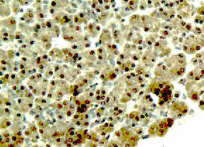 NT5C2 Rabbit Polyclonal Antibody