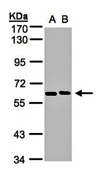 NT5C2 antibody