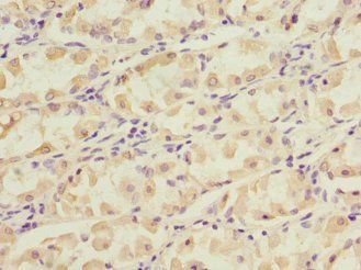 NT5C3A Antibody