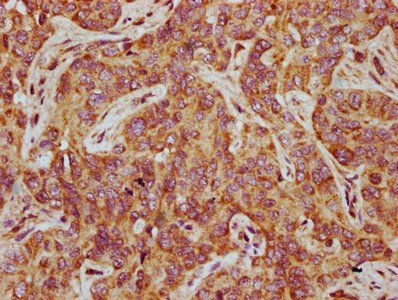 NTAN1 Antibody