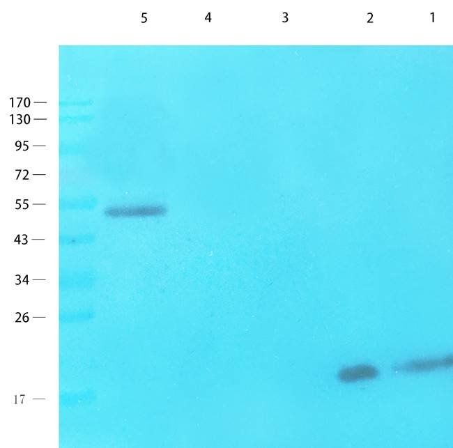 NTCP antibody