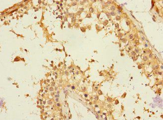 NTM Antibody