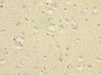 NTM Antibody