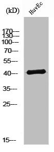 NTM antibody