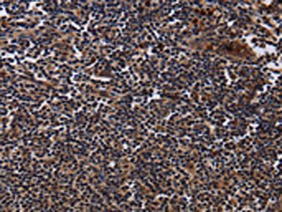 NTMT1 Antibody