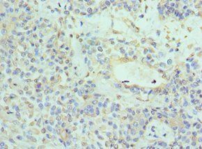 NTRK3 Antibody