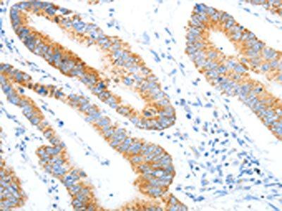 NTS Antibody