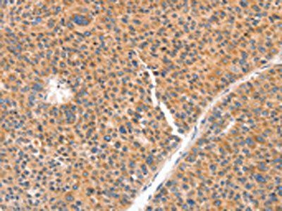 NUAK1 Antibody