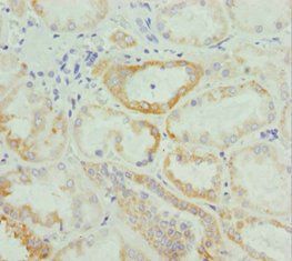 NUAK2 Antibody